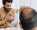 Hair loss at 25, heart problems at 40: Mumbai nutritionist shares health warning signs men ignore